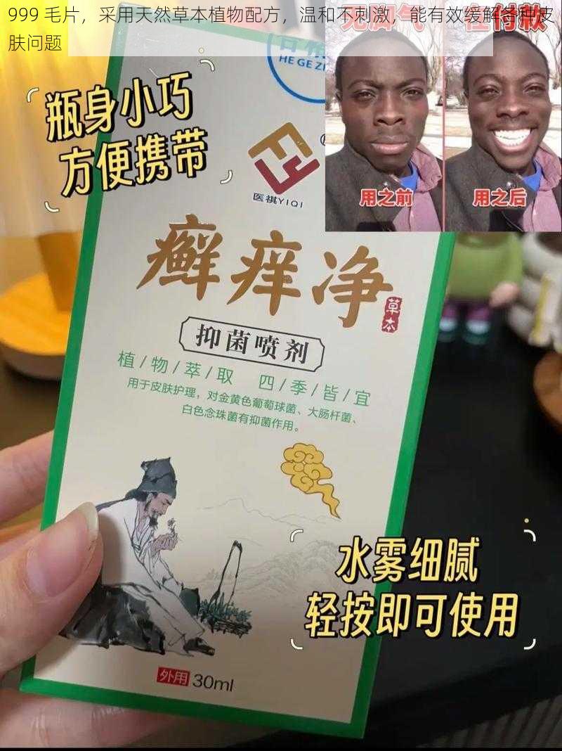 999 毛片，采用天然草本植物配方，温和不刺激，能有效缓解各种皮肤问题