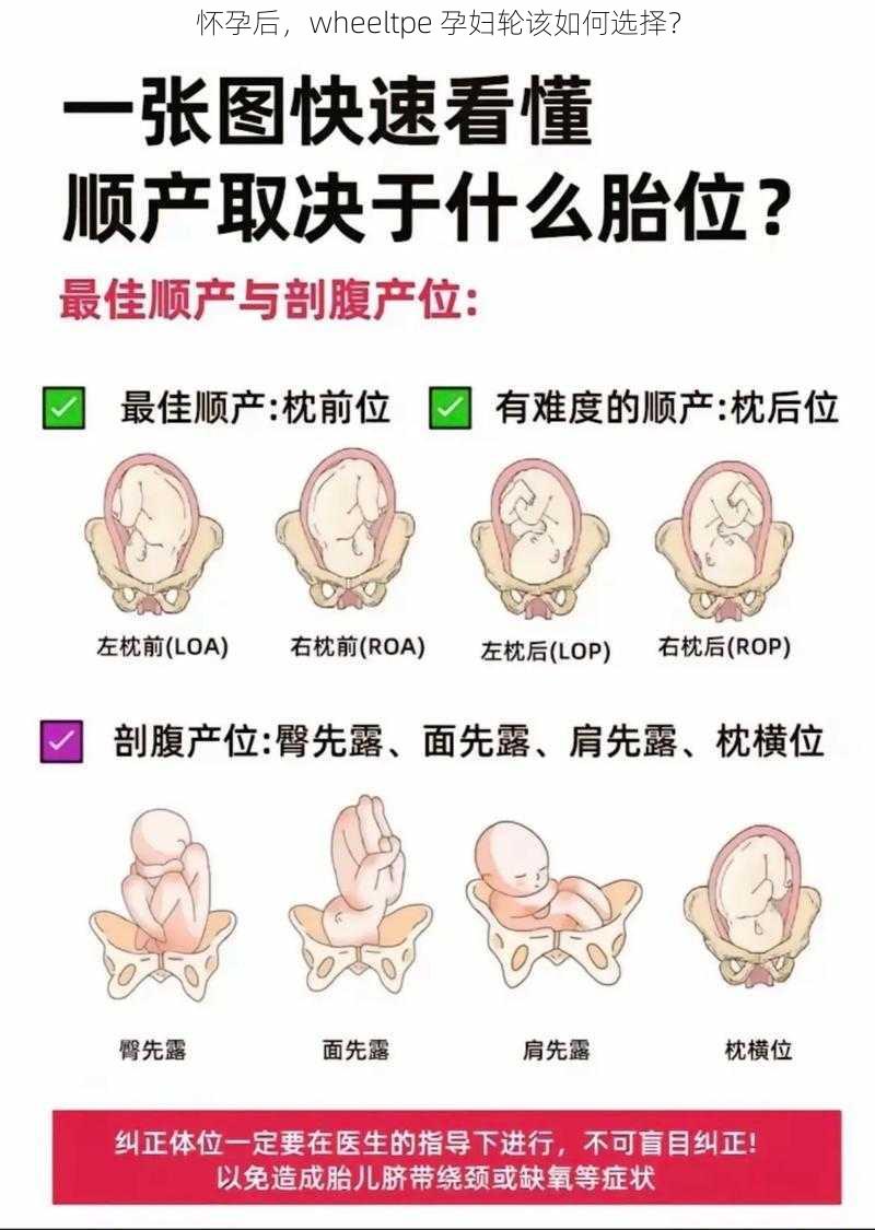 怀孕后，wheeltpe 孕妇轮该如何选择？