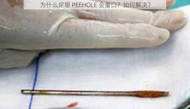 为什么尿眼 PEEHOLE 会重口？如何解决？